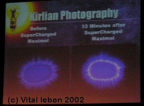 Kirlian Photo ber die positive Wirkung von Maximol Solutions auf eine unserer Krperzellen.